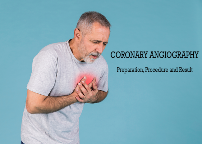 Coronary Angiography Treatment in Pune Coronary Angiography Treatment in Pune