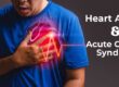 acute coronary syndrome treatment in Pune