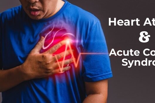 acute coronary syndrome treatment in Pune acute coronary syndrome treatment in Pune