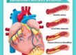 Coronary Artery Disease treatment in Pune